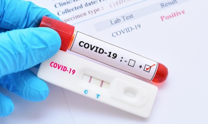 ръст заболелите 599 случаи covid нас