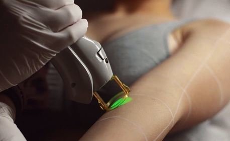 продължава разследването изтеклите интимни видеа клиенти студио лазерна епилация бургас