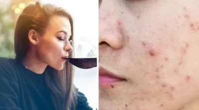 Вижте най-забележимите проблеми върху кожата при прекомерната употреба на алкохол