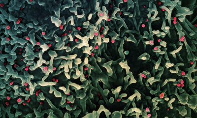 СЗО: Mpox не е новият COVID, но изисква решителни мерки