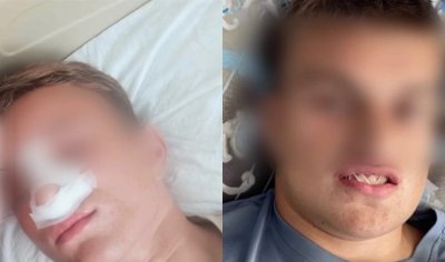 Отново бой между тийнейджъри, този път в Айтос, прати двама в болница