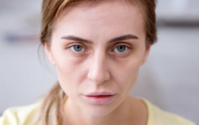 Какво казва лицето ви за вашето здраве: Цветови промени, които не бива да пренебрегвате