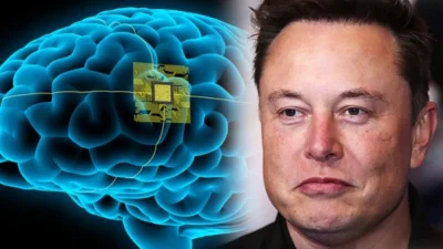 Neuralink имплантира мозъчен чип на трети човек: Успехите на компанията на Илон Мъск