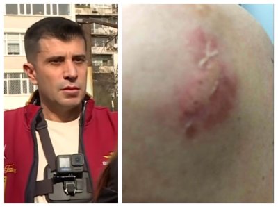 Като питбул! Училищна директорка ухапа Жоро Игнатов по време на снимки