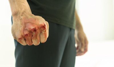Млад мъж пребит и ограбен от трима маскирани в собственото си жилище