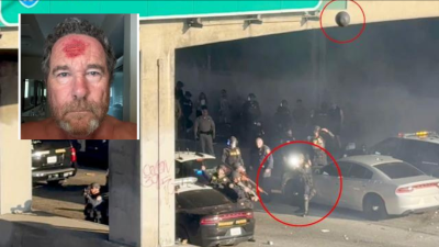 Фотограф на NY Post беше прострелян с гумен куршум по време на безредиците в Лос Анджелис