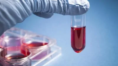 Япония тества универсална изкуствена кръв &ndash; революция в трансфузионната медицина на хоризонта