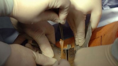 Кожа от мъртви палестинци? Откъде Израел попълва медицинската си банка за кожа за присаждане? (ВИДЕО)