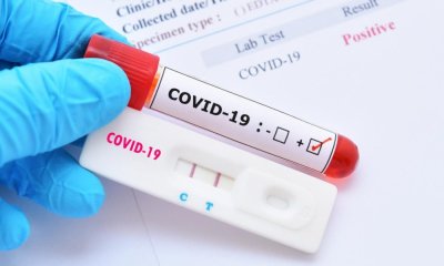 Ръст на заболелите: 599 нови случаи на COVID-19 у нас