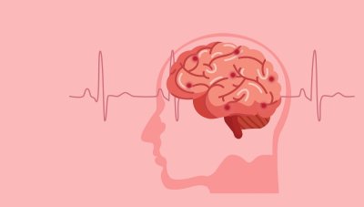 Инсулт при млади и средна възраст: 5 симптома, които не бива да пренебрегвате