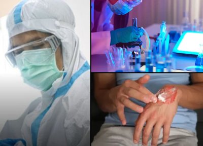Учени създадоха прах, който запечатва рани за секунда