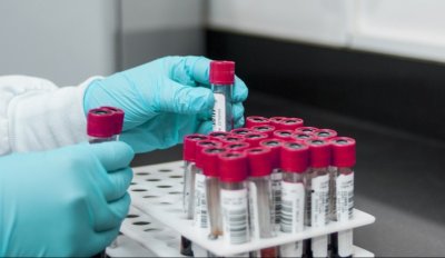 Нова промяна за шофьорите: Кръвните тестове за алкохол и наркотици вече ще излизат до дни