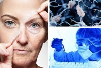 Учени откриха как стареенето се &bdquo;разпространява&ldquo; в тялото като инфекция