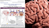 mRNA ваксините са свързани със сериозни рискове за мозъка (ВИДЕО)