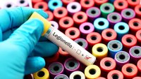 Регистриран е първият случай на легионерска болест за 2026 г.