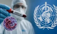 Ебола стигна и до Франция &ndash; лекар бе поставен под изолация